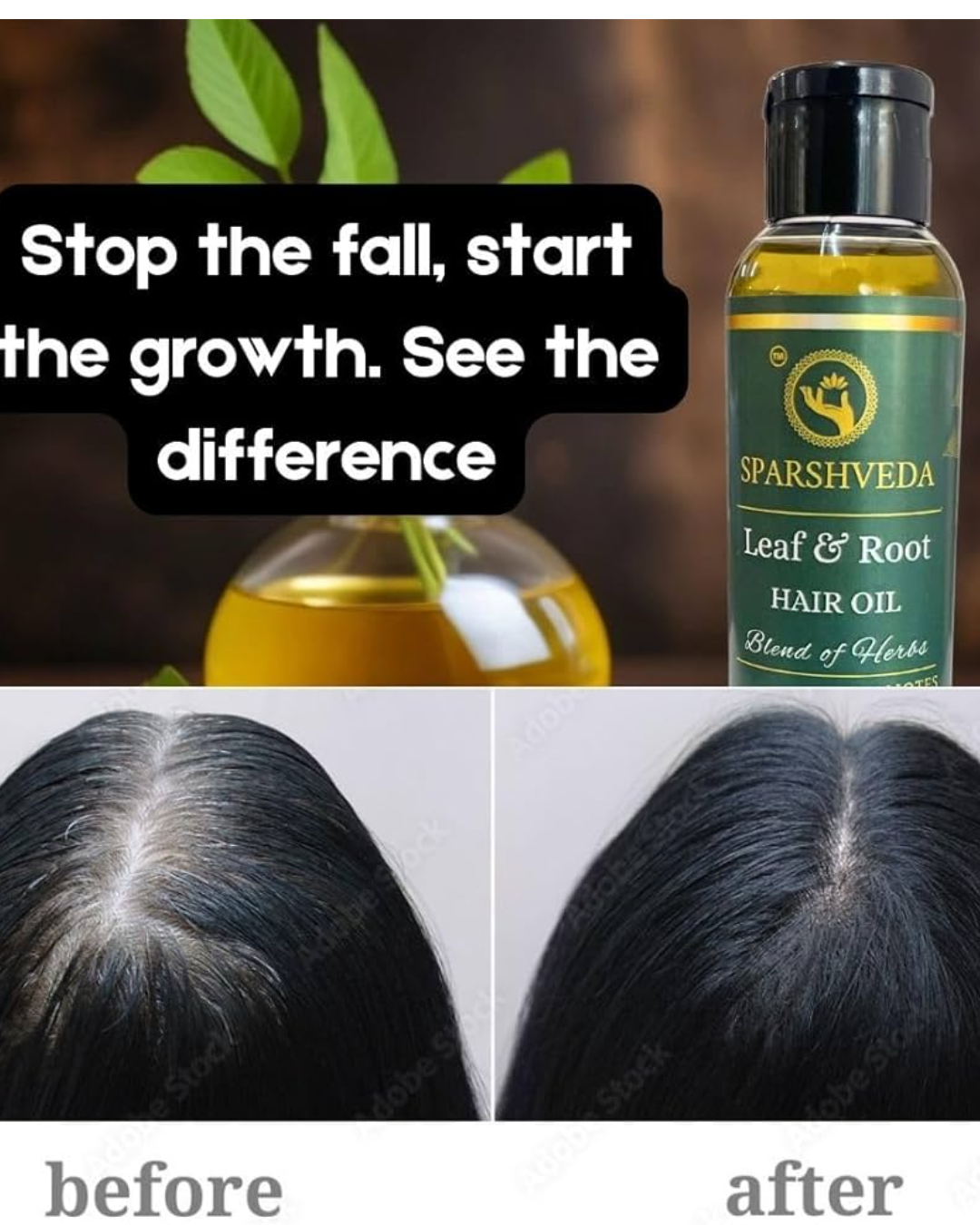 You are currently viewing Sparshveda Brahmi Oil 120ml – 100% Pure & Cold Pressed Ayurvedic Hair Oil