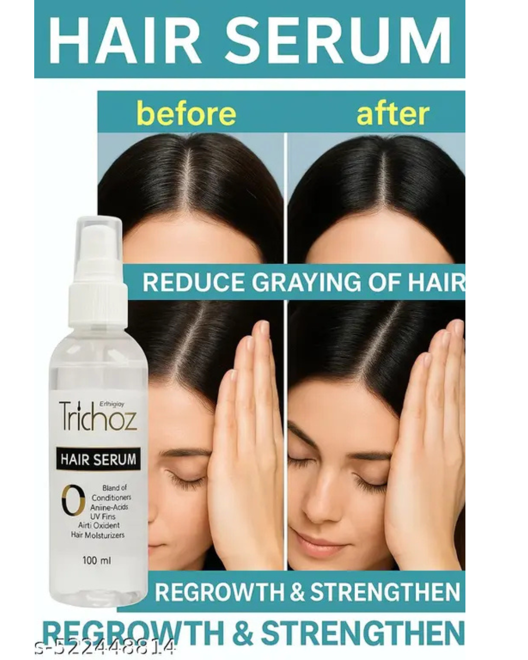 You are currently viewing Ethiglo Trichoz Intensive Hair Serum – Science-Backed Hair Regrowth Solution
