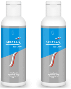 Read more about the article Global Pharma Alopecia Areata-X Lotion – Advanced Scalp & Hair Care Solution