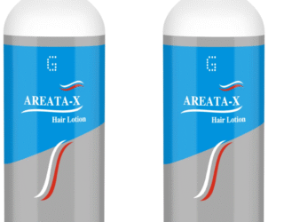 Global Pharma Alopecia Areata-X Lotion – Advanced Scalp & Hair Care Solution