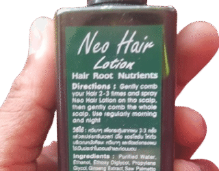 Green Wealth Neo Hair Lotion for Hair Loss Treatment – Honest Review, Results & How to Use Green Wealth Hair